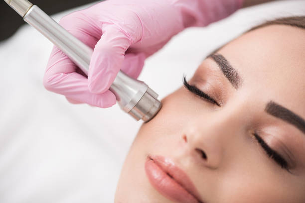 microdermabrasion treatment in dermatology clinic