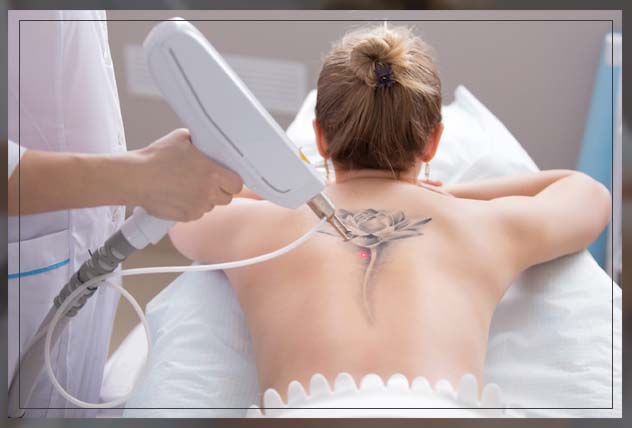 understanding laser treatments