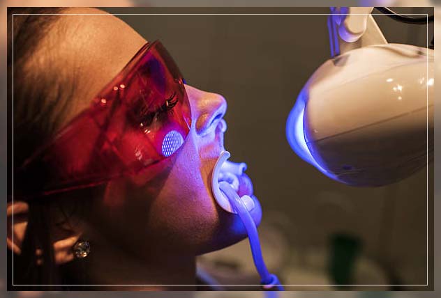 teeth whitening zoom in al wasl