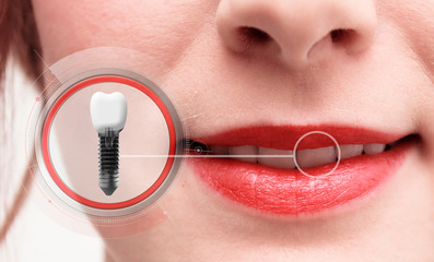 get the quality treatment for your teeth