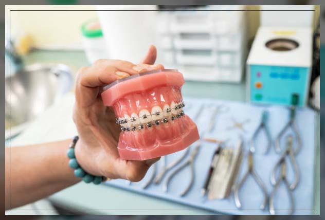 mouth model