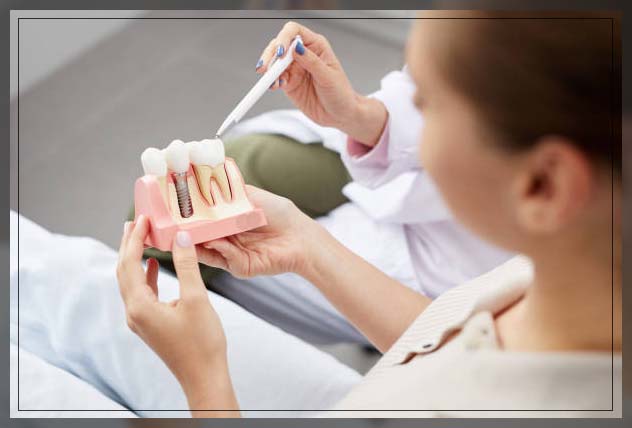 dental implant in Jumeirah