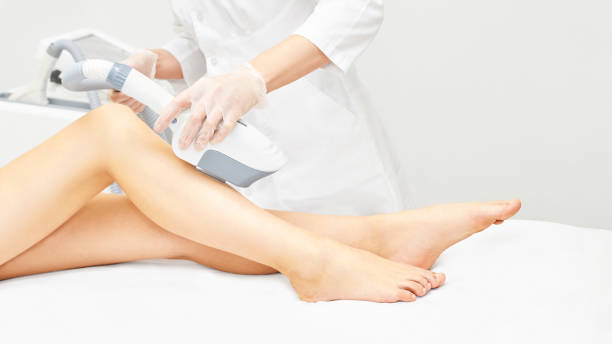 electrolysis hair removal