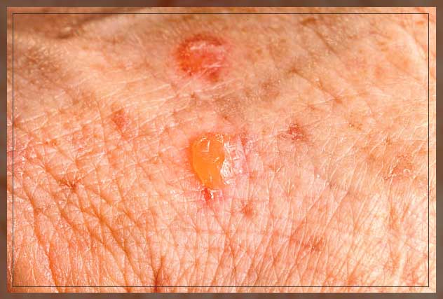 Skin disorders 16