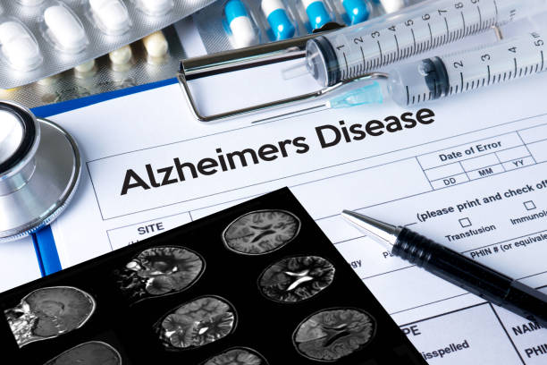 Alzheimer's disease