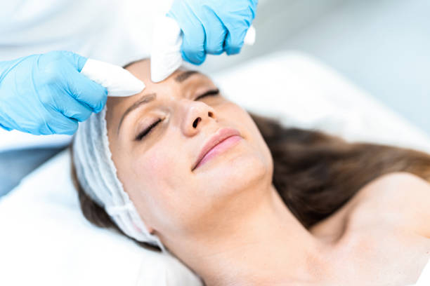 blackhead removal and treatment