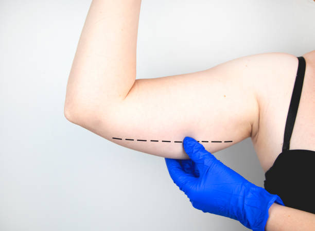 body contouring meaning