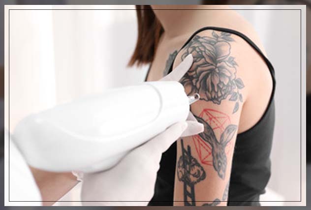 having a skin condition impacts how your tattoo will look