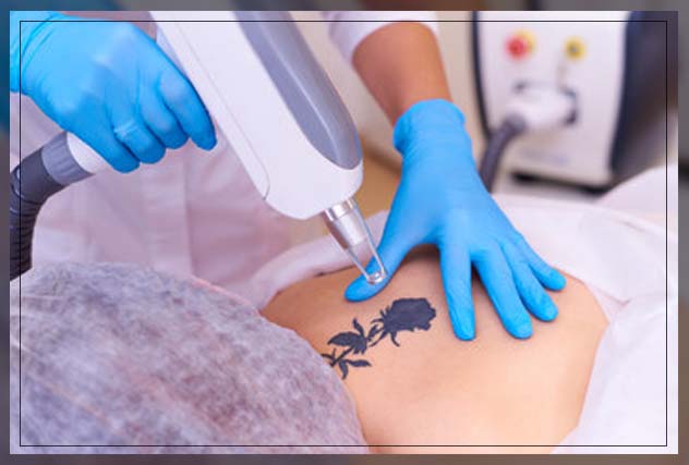 ensuring your tattoo remains healthy