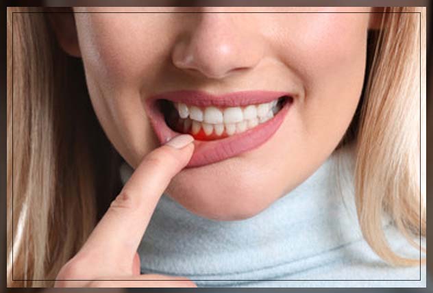 analyzing your periodontal disease