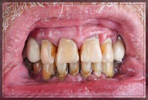 symptoms to watch out for 