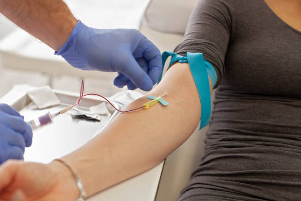prp treatment procedure