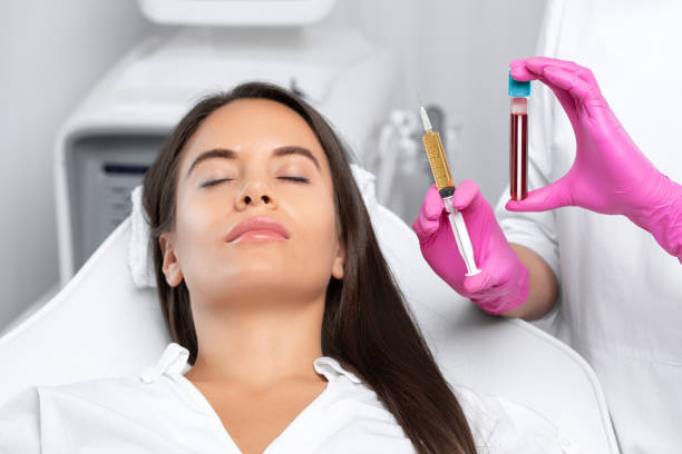 prp treatment facial