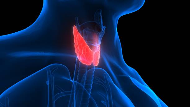 thyroid causes