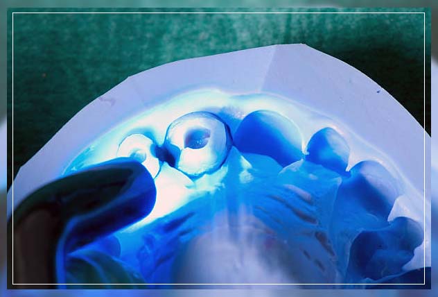 Composite filling 13