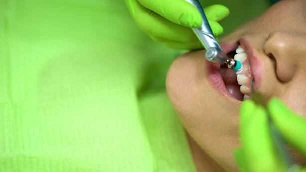 Dental Scaling and Polishing