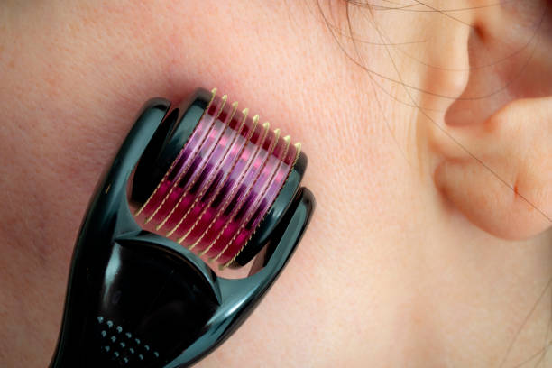 Derma Rollers