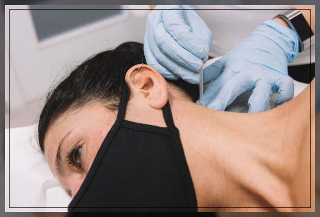 Dry needling 13