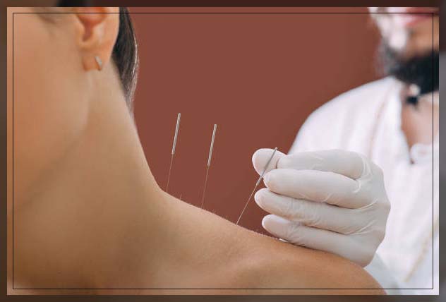 Dry needling 16