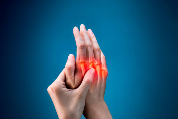 Rheumatoid Arthritis: