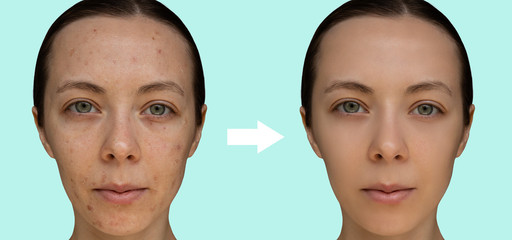 see difference in a few treatments