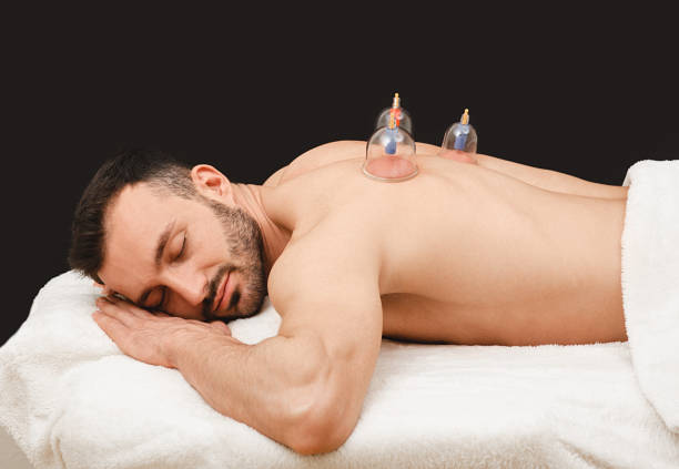 dry cupping therapy