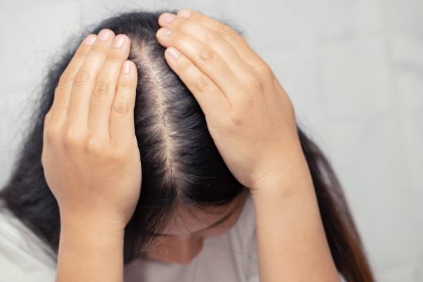 hair loss due to stress, homronal balance