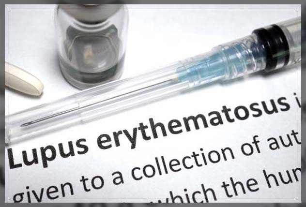 lupus
