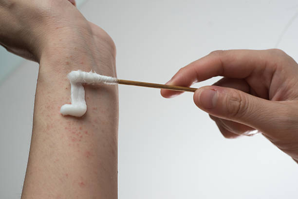 medication for psoriasis