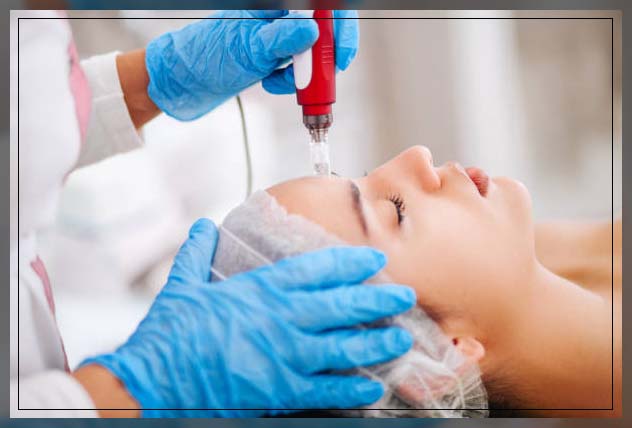 profound rf treatment