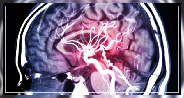 reversable conditions