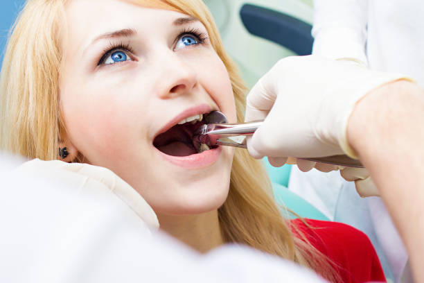 Wisdom teeth 11