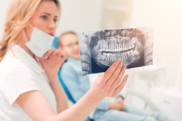 Wisdom teeth 8
