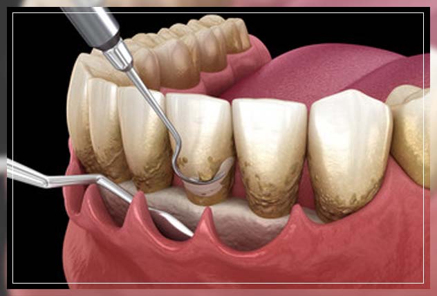 looking at how to solve the issue of bad breath