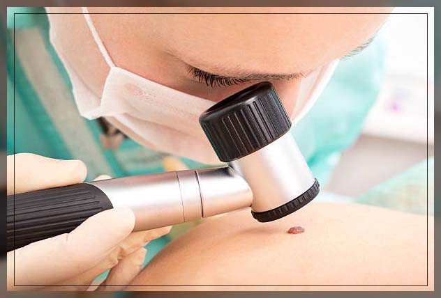doctor performing mole removal procedure