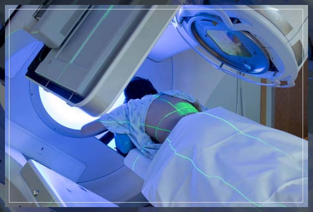 radiation therapy