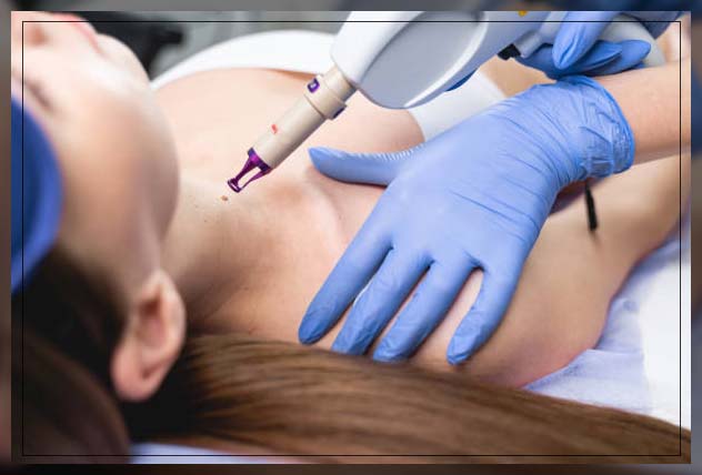 doctor performing laser for scars