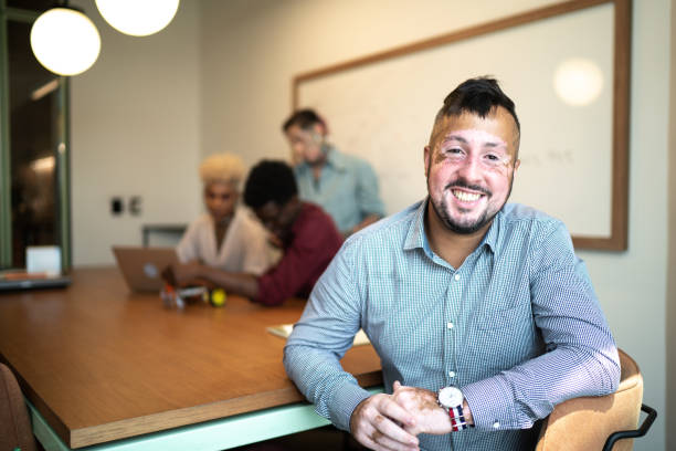 Skin diseases vitiligo