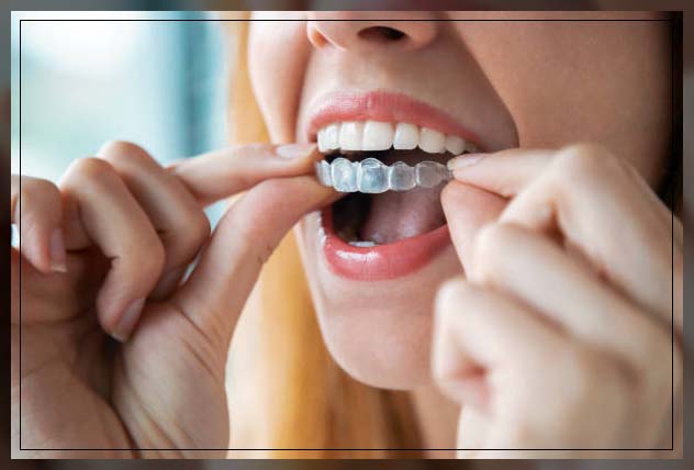 woman putting on retainers after procedure