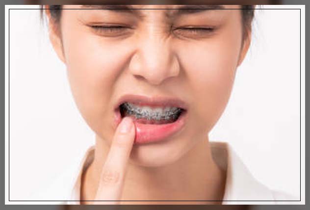 woman with pain in mouth