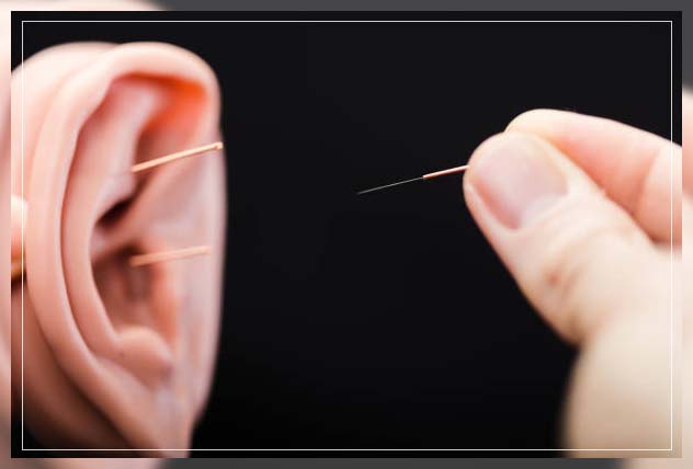 acupuncture treatment of ringing in ears