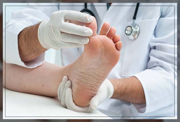 Fungal infection skin 11