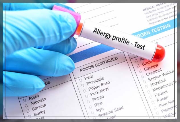 allergy test