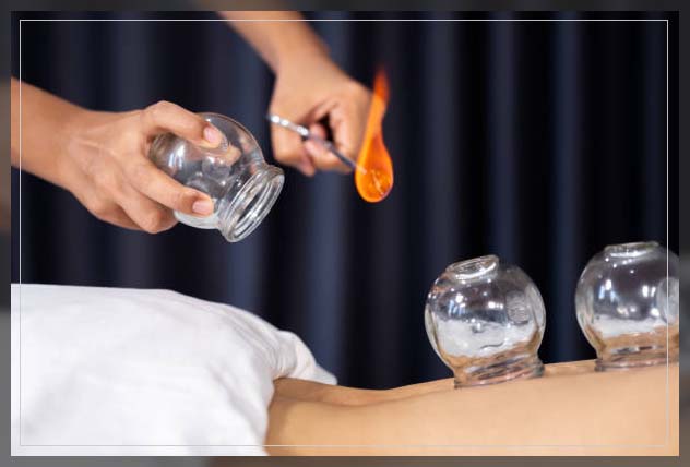 cupping therapy types