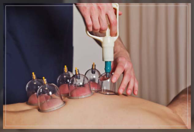 using rubber suction on body