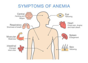 how to know if you have anemia 