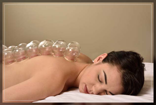 Cupping benefits 13