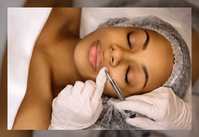 Dermal Fillers 1