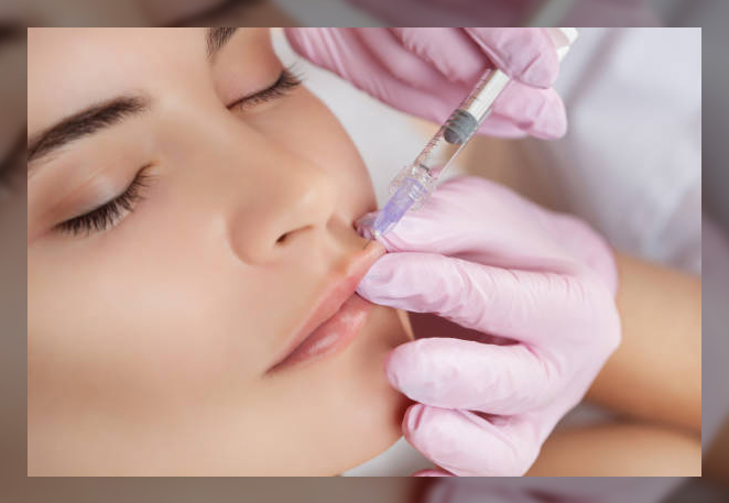 Dermal Fillers 4