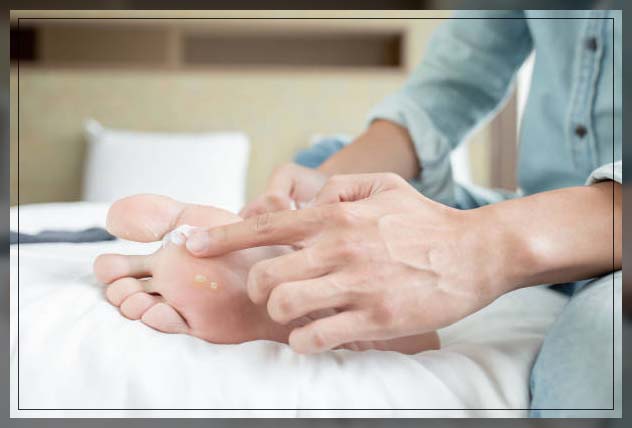 Fungal Skin Infection 15